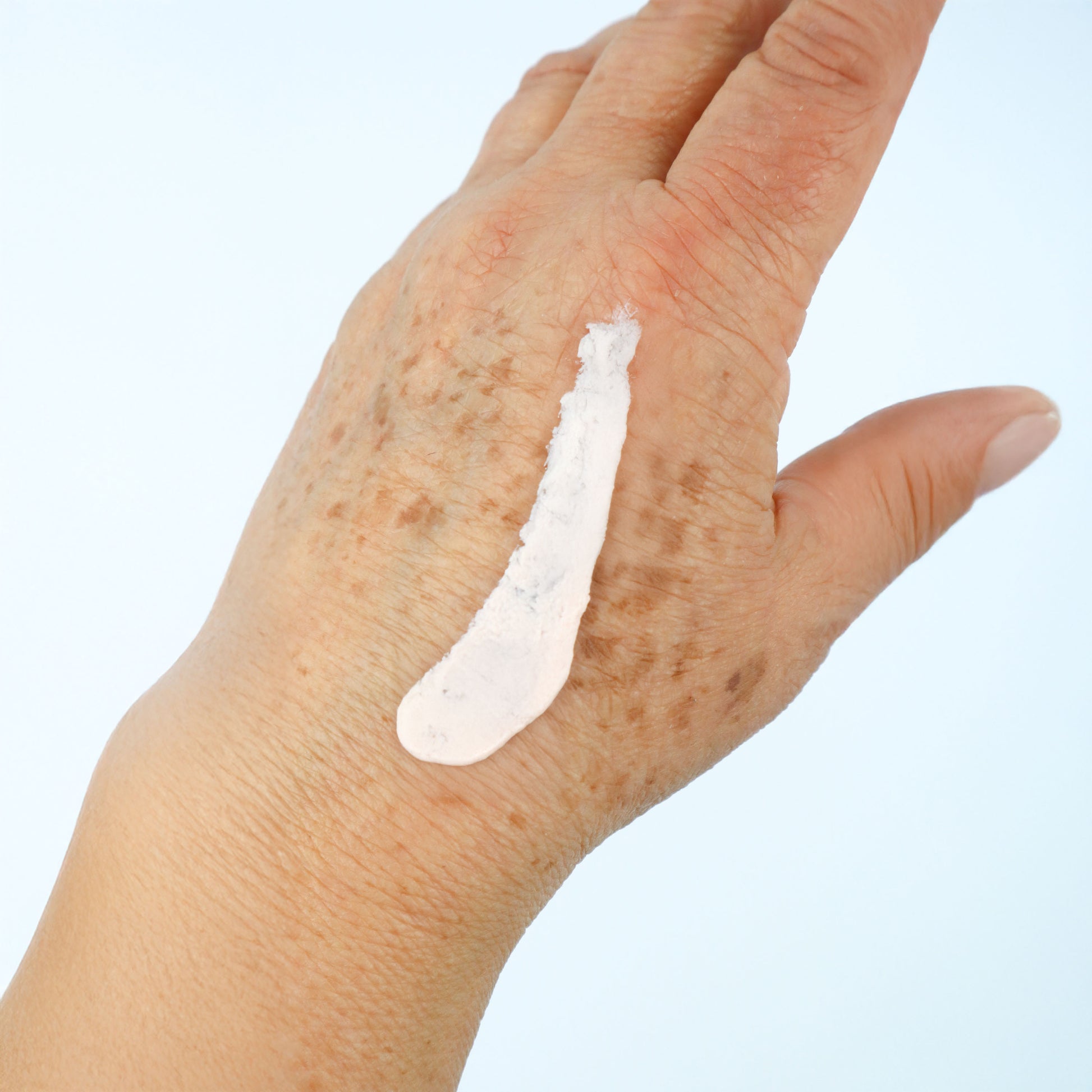 Mano de persona mayor con crema para la rasquiña en la piel