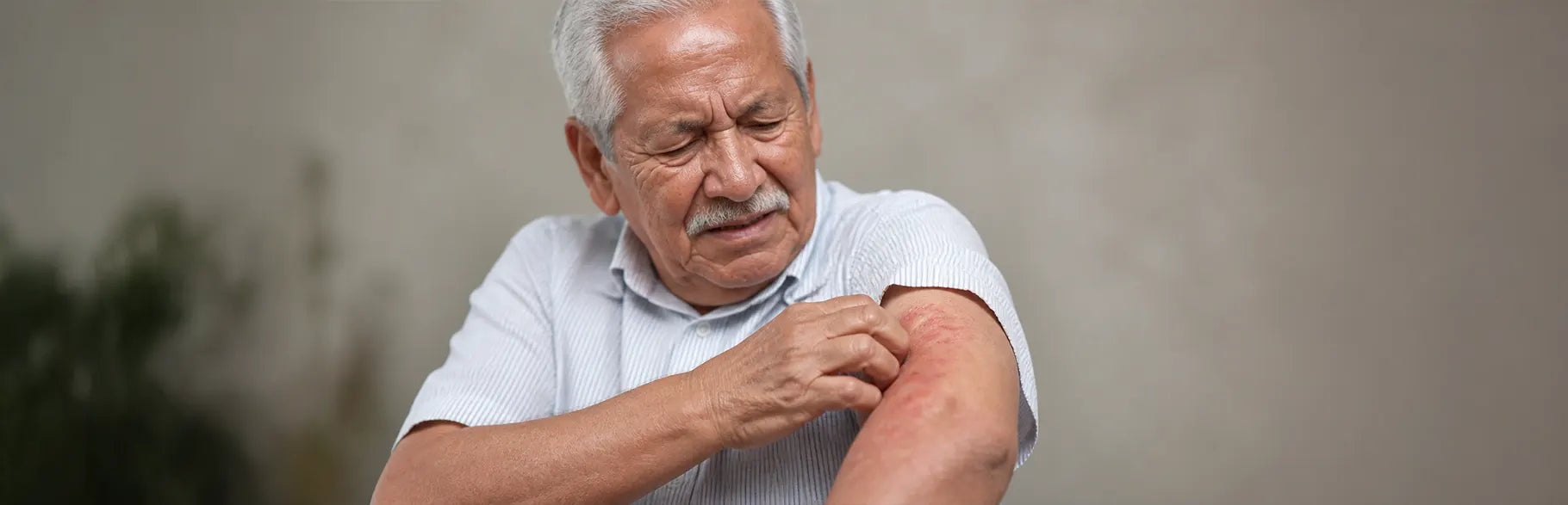 Qué debe saber sobre el Herpes Zóster y sus efectos en la piel durante la vejez