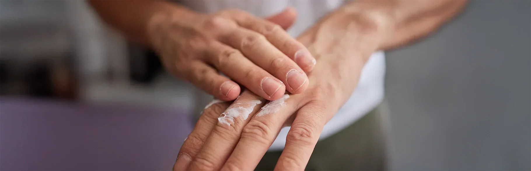 ¿Siente escozor? necesita una crema para la picazón en la piel